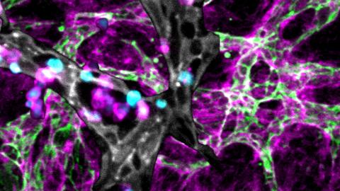 bone-marrow-on-chip.jpg